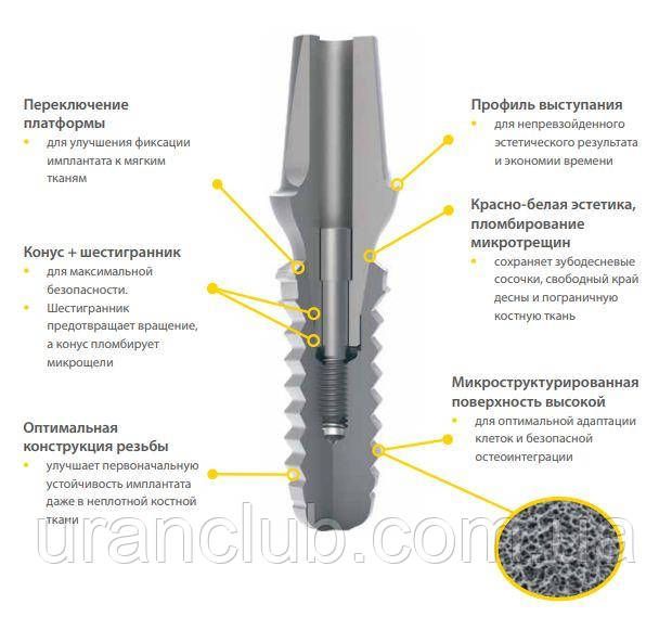 Импланты системы IMPLA Micro Retention с коническим соединением диаметр 5, 3 мм длина 11, 5 мм