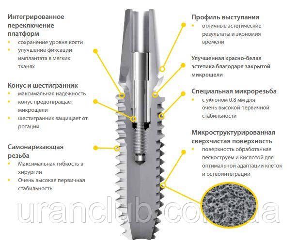 Импланты системы IMPLA Cylindrical с коническим соединением диаметр 4, 5 мм длина 8мм