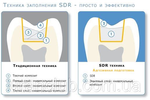 Композит для реставрации боковой группы зубов SDR, Dentsply шпр. 1 гр.