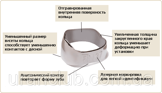Бандажні кільця на моляри, Леоне (Італія) 