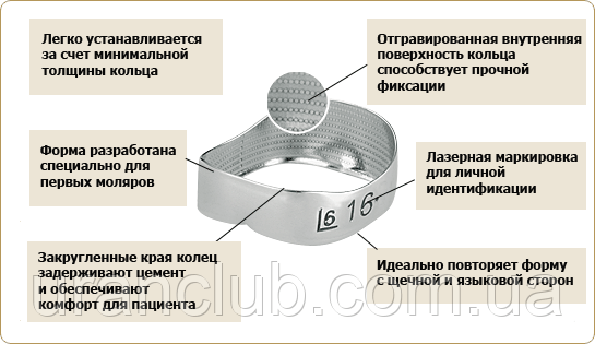 Бандажні кільця на моляри, Леоне (Італія) 